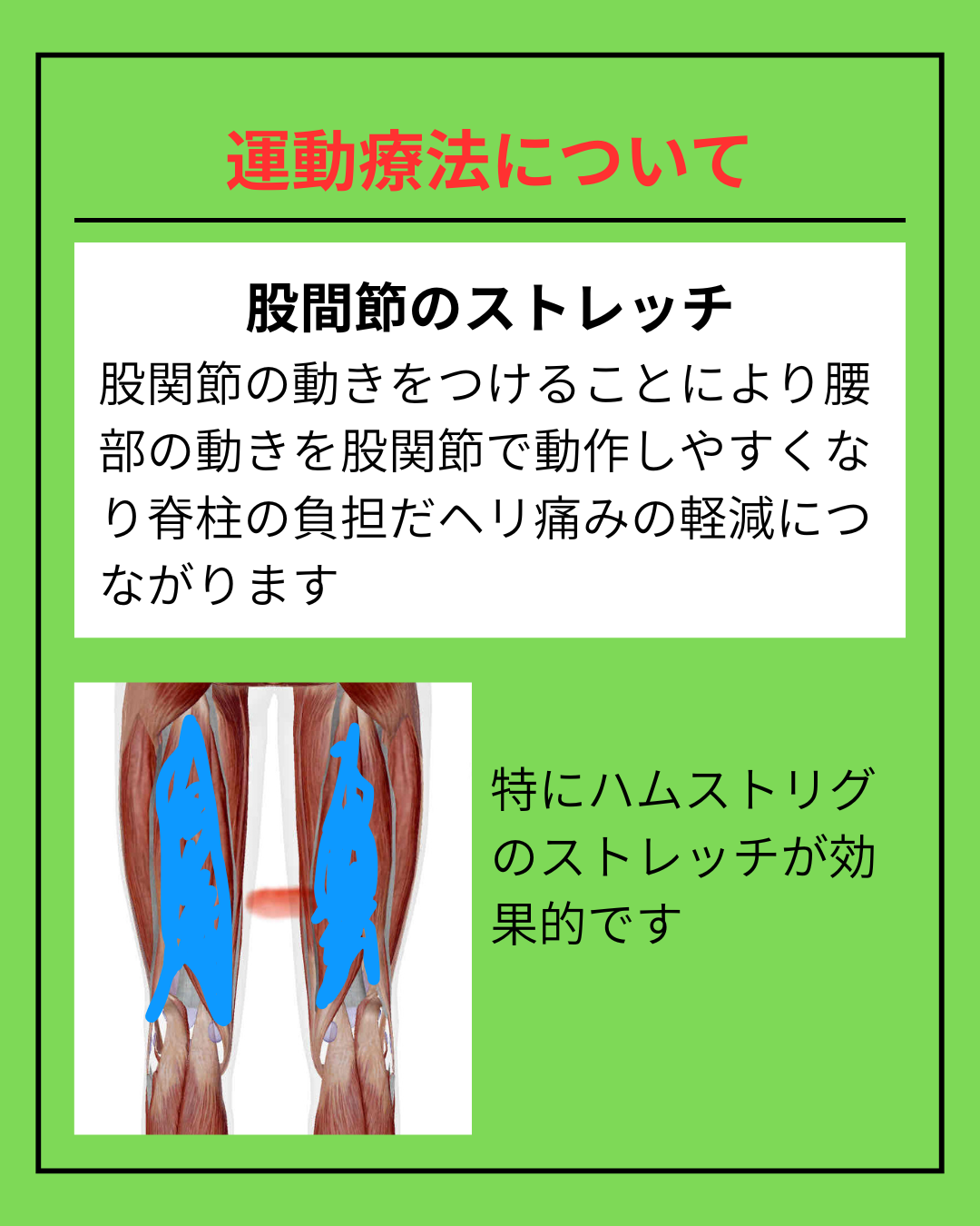 腰痛のセルフケアを説明している様子