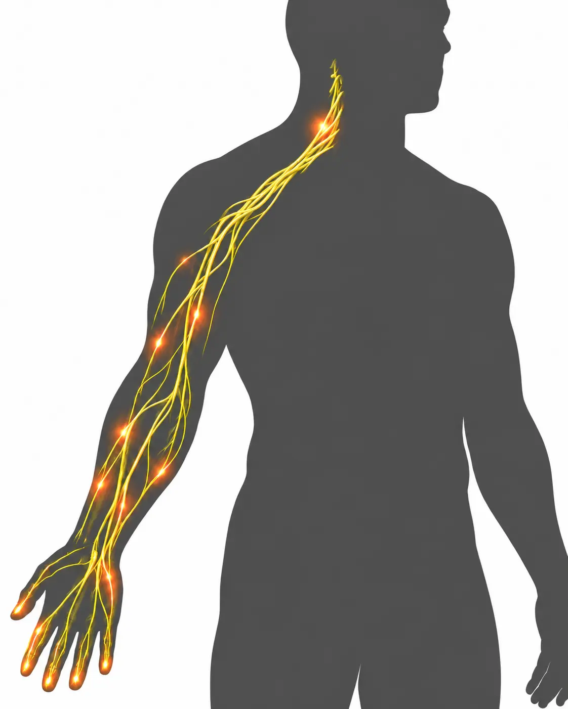 首の付け根から腕へ広がる斜角筋症候群の症状イメージ